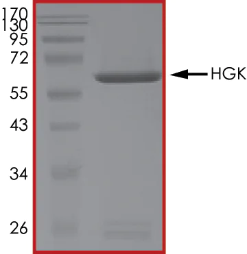 SDS-PAGE - Recombinant human MAP4K4/NIK protein (AB101775)