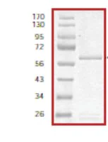 SDS-PAGE - Recombinant human MAP4K6 protein (AB55712)