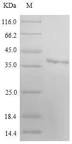 SDS-PAGE - Recombinant human MARCH2 protein (His tag) (AB314524)