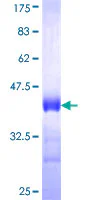 SDS-PAGE - Recombinant Human MARCKS protein (GST tag N-Terminus) (AB152508)