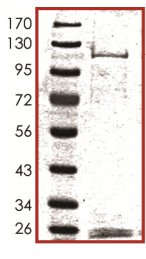 SDS-PAGE - Recombinant human MARK2 protein (AB119135), expandable thumbnail