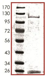 SDS-PAGE - Recombinant human MARK2 protein (AB119135)