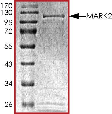 SDS-PAGE - Recombinant human MARK2 protein (AB119135), expandable thumbnail