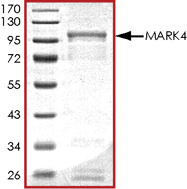 SDS-PAGE - Recombinant human MARK4 protein (AB105211)