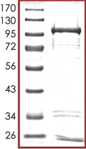 SDS-PAGE - Recombinant human MARK4 protein (AB105211), expandable thumbnail