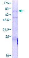 Recombinant Human MASP1 protein