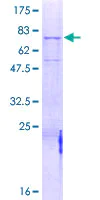 SDS-PAGE - Recombinant Human MASP1 protein (AB159246)