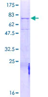 SDS-PAGE - Recombinant Human MASP1 protein (GST tag N-Terminus) (AB159246)