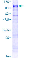 Recombinant Human MASP2 protein