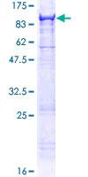 SDS-PAGE - Recombinant Human MASP2 protein (GST tag N-Terminus) (AB161136)