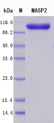SDS-PAGE - Recombinant Human MASP2 Protein Standard (His tag) (AB316432), expandable thumbnail