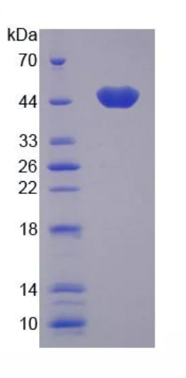 SDS-PAGE - Recombinant Human MASPIN protein (His tag) (AB275794)