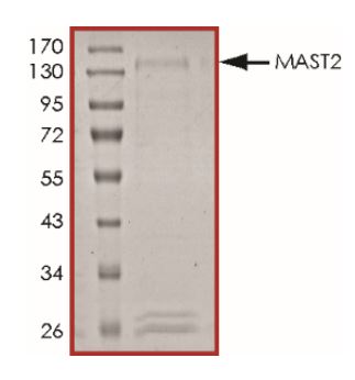 SDS-PAGE - Recombinant Human MAST205 protein (Tagged) (AB268745)