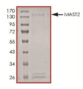 SDS-PAGE - Recombinant Human MAST205 protein (Tagged) (AB268745)