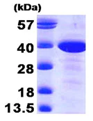 SDS-PAGE - Recombinant Human MAT2B/TGR protein (AB89357)