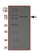 SDS-PAGE - Recombinant human MATK protein (AB204136), expandable thumbnail