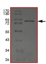SDS-PAGE - Recombinant human MATK protein (AB204136)