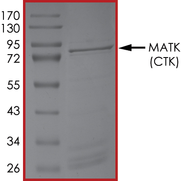 SDS-PAGE - Recombinant human MATK protein (AB204136), expandable thumbnail