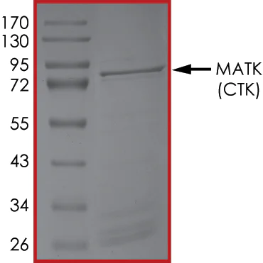 SDS-PAGE - Recombinant human MATK protein (AB204136)
