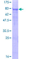 Recombinant Human Matriptase 2 protein