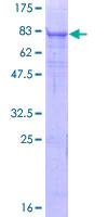 SDS-PAGE - Recombinant Human Matriptase 2 protein (AB132358)