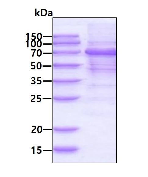 SDS-PAGE - Recombinant Human MAVS protein (His tag N-Terminus) (AB139779)