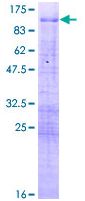 SDS-PAGE - Recombinant Human MBD1 protein (AB152512)