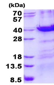 SDS-PAGE - Recombinant Human MBD3 protein (His tag N-Terminus) (AB134609)