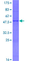 SDS-PAGE - Recombinant Human MBD3L1 protein (AB164770), expandable thumbnail