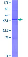 SDS-PAGE - Recombinant Human MBD3L1 protein (GST tag N-Terminus) (AB164770)