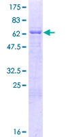 SDS-PAGE - Recombinant Human MBNL2 protein (GST tag N-Terminus) (AB160843)