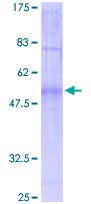 SDS-PAGE - Recombinant Human MC1-R protein (GST tag N-Terminus) (AB152515)