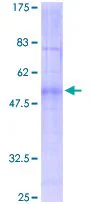 SDS-PAGE - Recombinant Human MC1-R protein (AB152515)