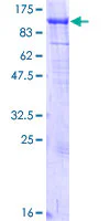 SDS-PAGE - Recombinant Human MCAK protein (GST tag N-Terminus) (AB132006)