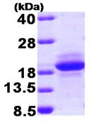 SDS-PAGE - Recombinant Human MCFD2 protein (AB92930)