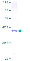 SDS-PAGE - Recombinant Human MCJ protein (AB162220)