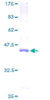 SDS-PAGE - Recombinant Human MCJ protein (GST tag N-Terminus) (AB162220)