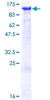SDS-PAGE - Recombinant Human MCM6 protein (AB114758)
