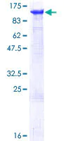 SDS-PAGE - Recombinant Human MCM6 protein (AB114758)