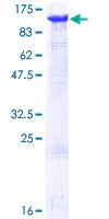 SDS-PAGE - Recombinant Human MCM6 protein (GST tag N-Terminus) (AB114758)