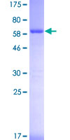 Recombinant Human MCM7/PRL protein