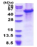 SDS-PAGE - Recombinant Human MCM7/PRL protein (denatured) (AB177663)