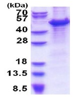 SDS-PAGE - Recombinant Human MCM7/PRL protein (denatured) (His tag N-Terminus) (AB177663)