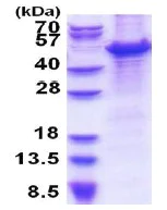 SDS-PAGE - Recombinant Human MCM7/PRL protein (denatured) (His tag N-Terminus) (AB177663)