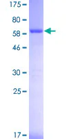 SDS-PAGE - Recombinant Human MCM7/PRL protein (GST tag N-Terminus) (AB114356)