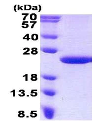 SDS-PAGE - Recombinant Human MCTS1/MCT-1 protein (AB140541)