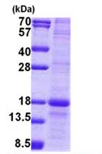 SDS-PAGE - Recombinant Human MD1 protein (denatured) (AB167887), expandable thumbnail