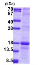 SDS-PAGE - Recombinant Human MD1 protein (denatured) (His tag N-Terminus) (AB167887)