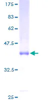 SDS-PAGE - Recombinant Human MD2 protein (GST tag N-Terminus) (AB132303)