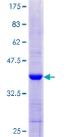 SDS-PAGE - Recombinant Human MDA5 protein (GST tag N-Terminus) (AB112423)